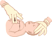 Infant CPR Compressions